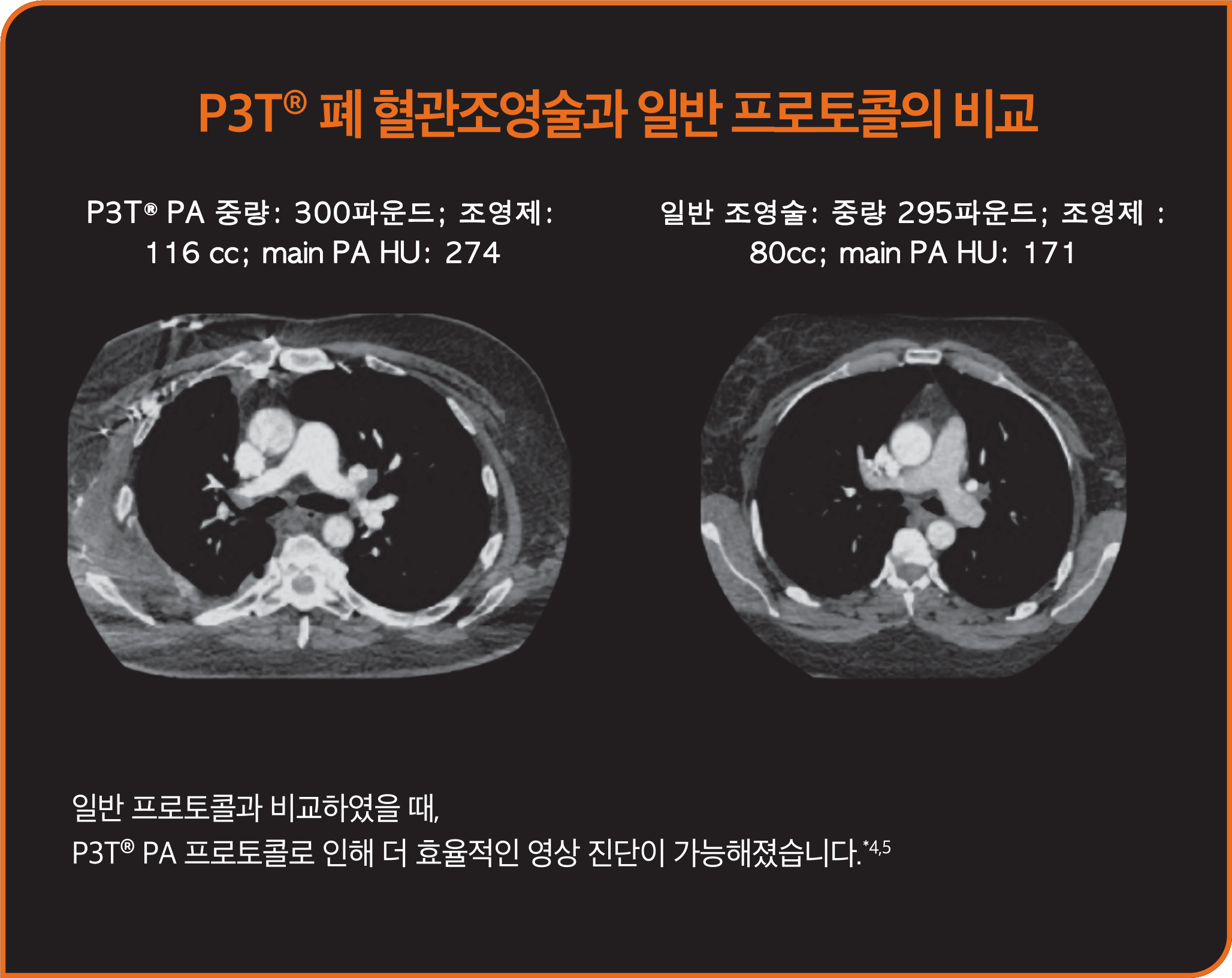 환자별로 개별화된 프로토콜