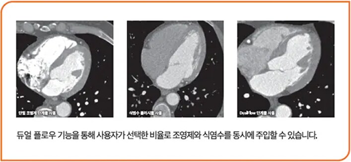 듀얼 플로우(Dual Flow) 비교2