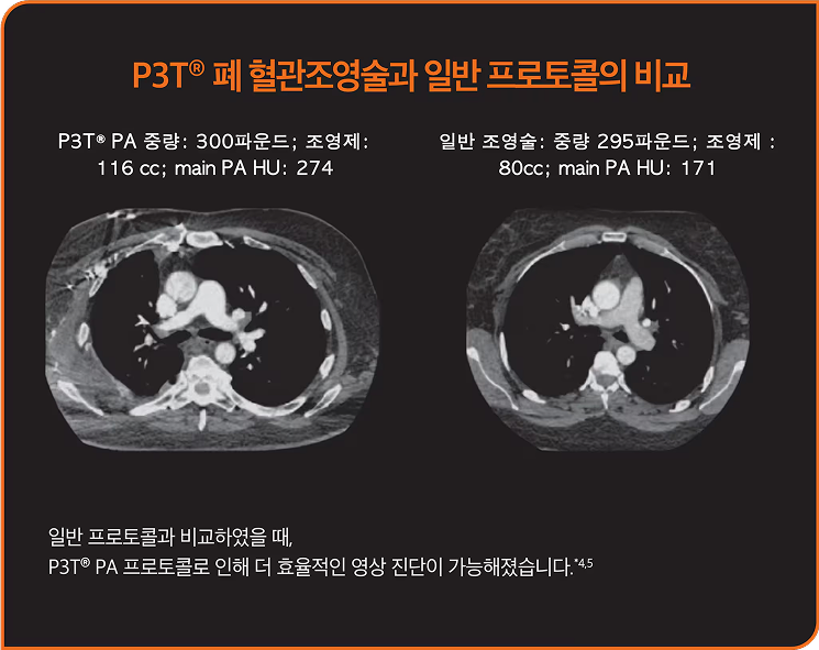P3T# Personalized Protocol
